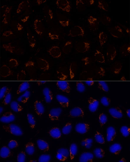 TRAP1 antibody