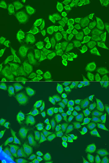 IGF2BP2 Rabbit Polyclonal Antibody