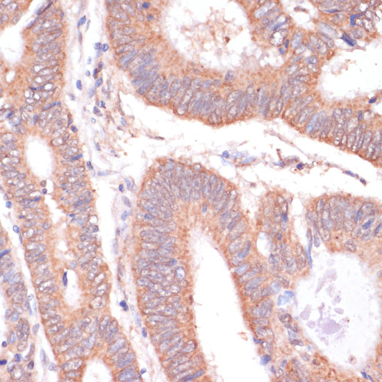 KCNH2 antibody