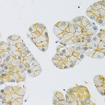SLC16A1 antibody