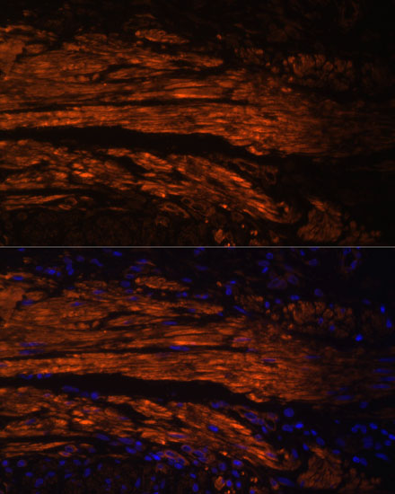 MYL9 antibody
