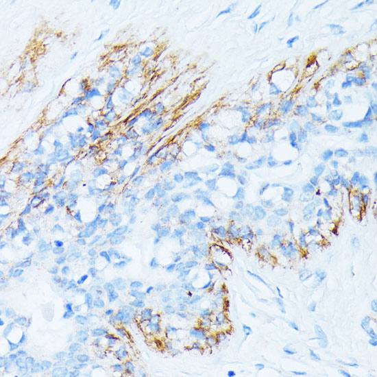TPM2 antibody