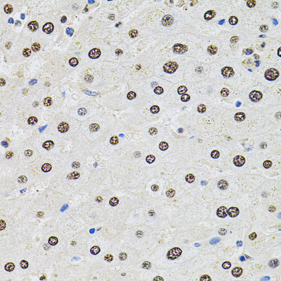 U2SURP Polyclonal Antibody