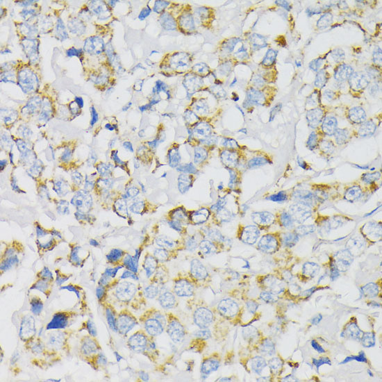 ATP5J Rabbit Polyclonal Antibody