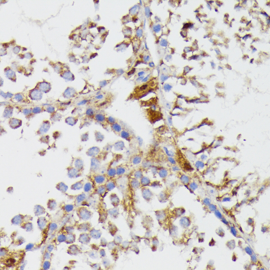 GALC Rabbit Polyclonal Antibody