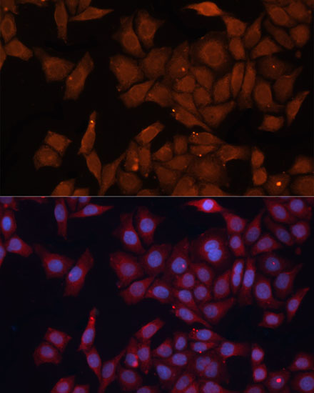 HMGCS1 Rabbit Polyclonal Antibody