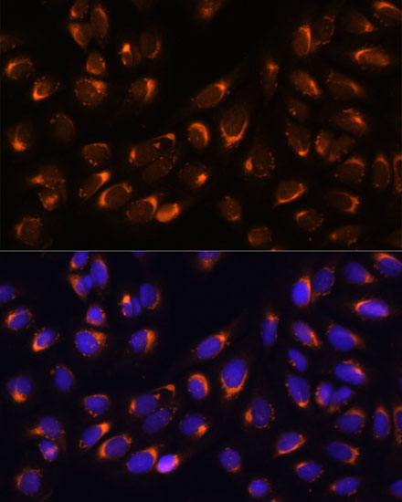 NUCB1 Polyclonal Antibody