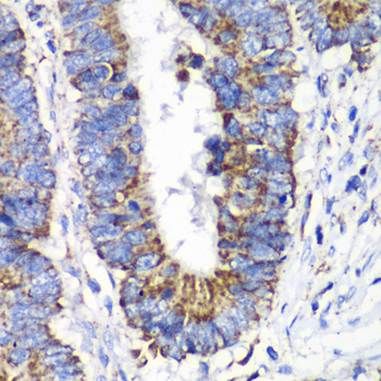 RALB Rabbit Polyclonal Antibody