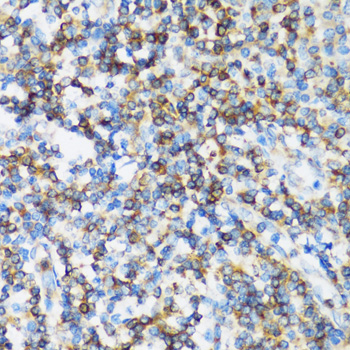 ARHGEF1 Polyclonal Antibody