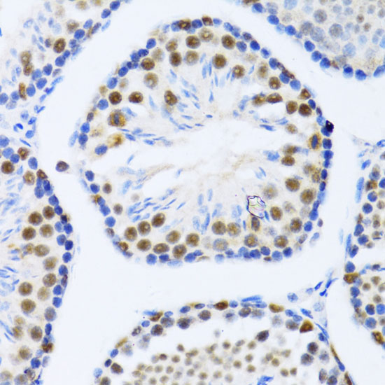DDX46 Polyclonal Antibody