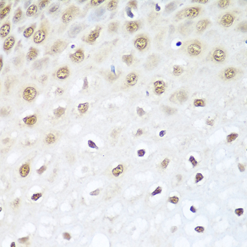 BCAS2 Rabbit Polyclonal Antibody