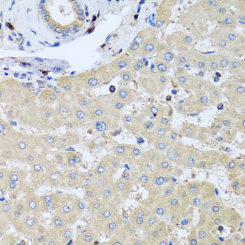 COTL1 Polyclonal Antibody