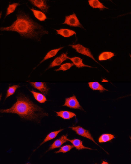SERPINA10 Polyclonal Antibody