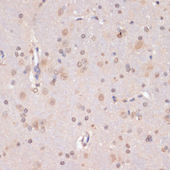 PIDD Polyclonal Antibody