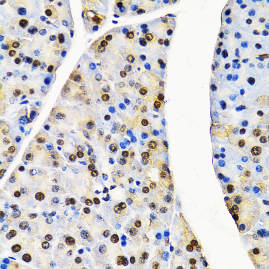 CUL4B antibody