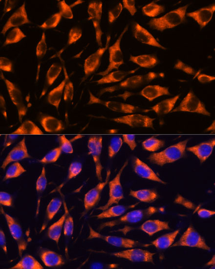 RIPK3 antibody