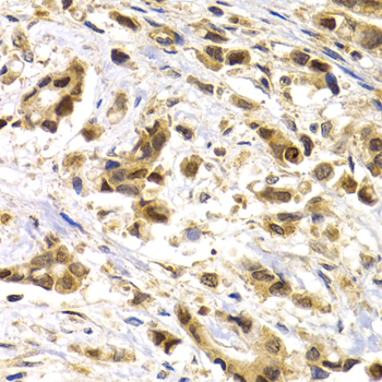 MAGEA1 antibody