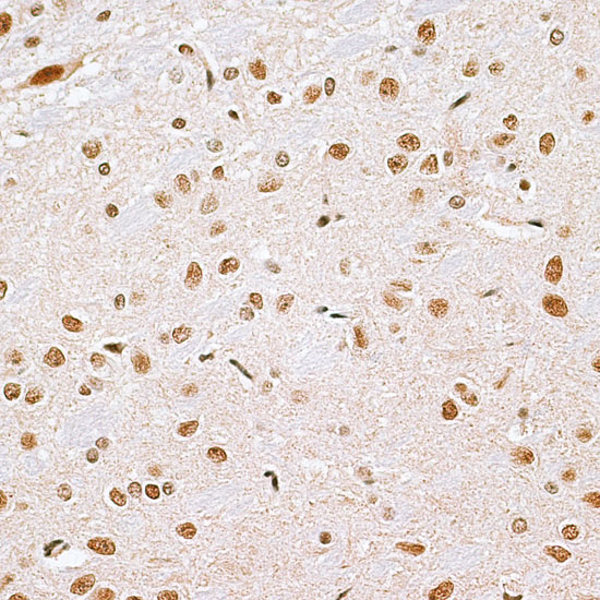 CBX6 Rabbit Polyclonal Antibody