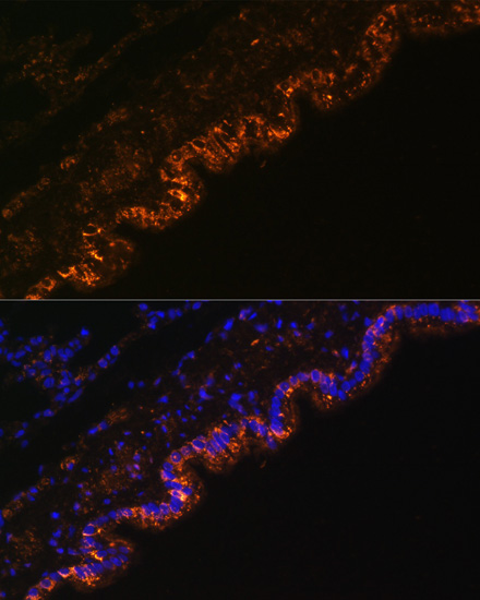 SCNN1A Rabbit Polyclonal Antibody