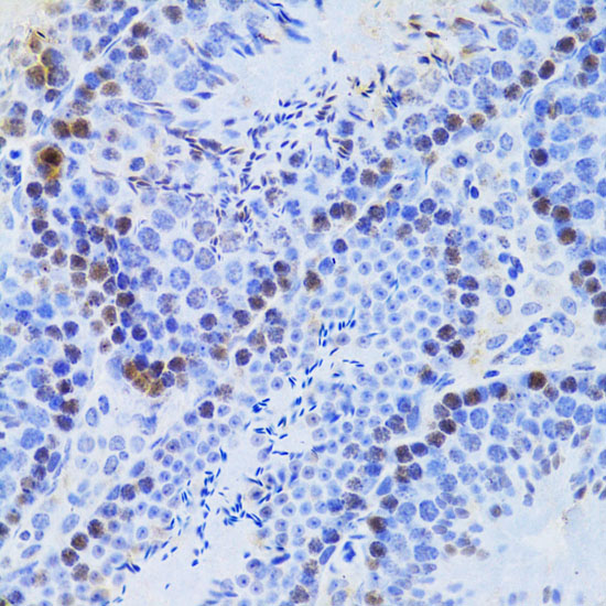 JMJD6 Antibody