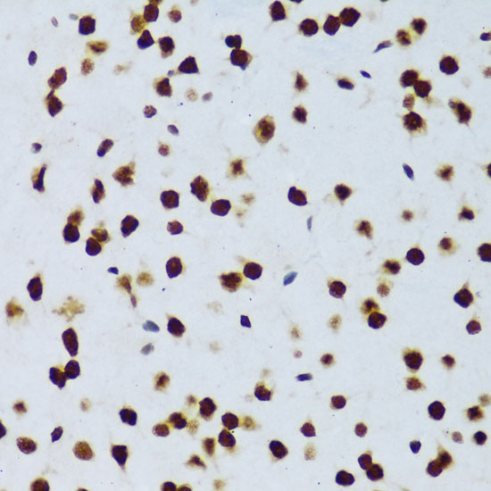 FUS Polyclonal Antibody