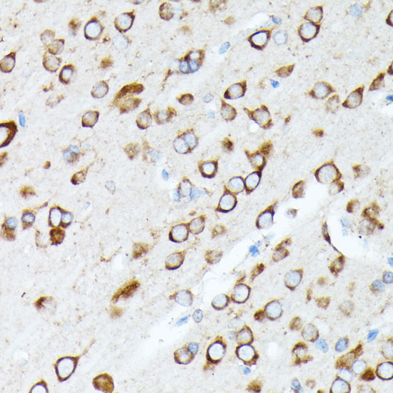 RPL7 Polyclonal Antibody