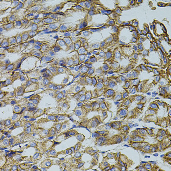 TRMT2A Polyclonal Antibody