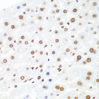 EIF2C2 Polyclonal Antibody