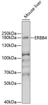 ERBB4 Rabbit Polyclonal Antibody