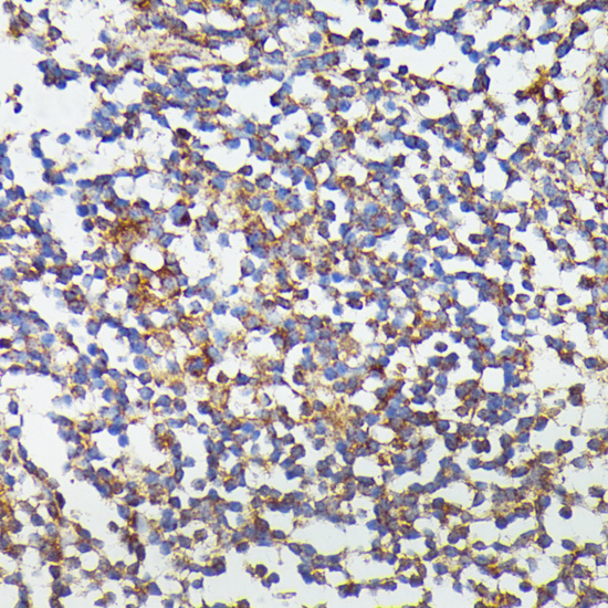 CSF3 Rabbit Polyclonal Antibody