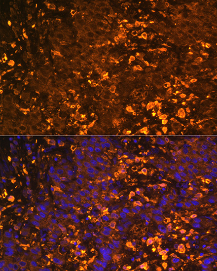 UGT1A1 Antibody