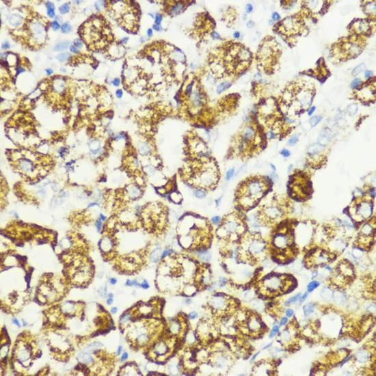 AKT1S1 antibody