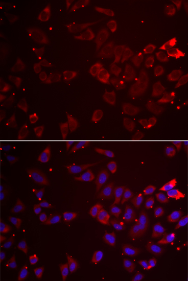 GATM antibody