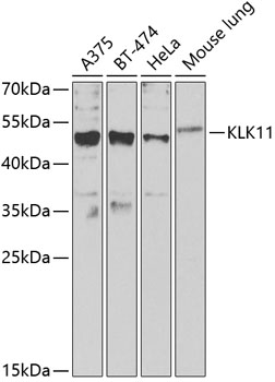 KLK11 Rabbit Polyclonal Antibody