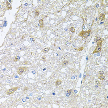 RAPSN Polyclonal Antibody