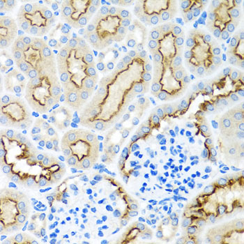 RPS2 Rabbit Polyclonal Antibody