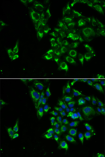 TSHB antibody