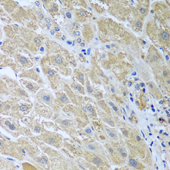 WDR48 Polyclonal Antibody