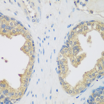 ENPEP Rabbit Polyclonal Antibody