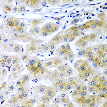RARRES2 Polyclonal Antibody