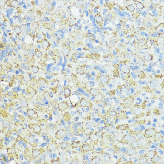 SOD3 Polyclonal Antibody