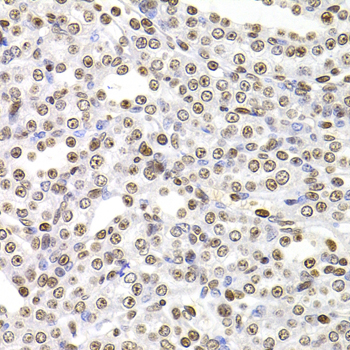 SOX5 Polyclonal Antibody