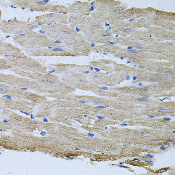 TARS Polyclonal Antibody