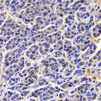 HIRIP3 Polyclonal Antibody