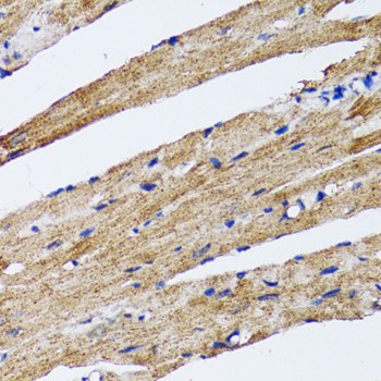 LC3B Polyclonal Antibody