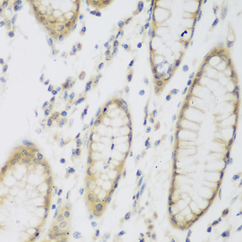 NAT8B Polyclonal Antibody