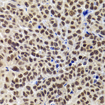PHIP Polyclonal Antibody