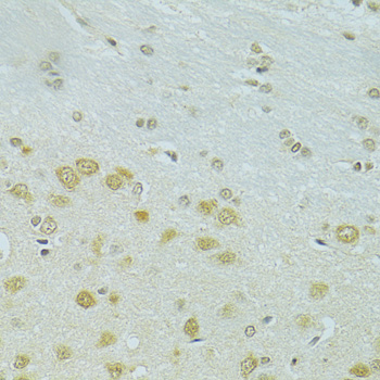 RSRC1 Polyclonal Antibody
