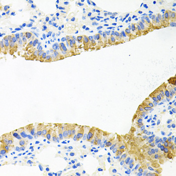 TOB2 Polyclonal Antibody
