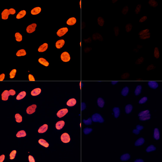 Histone H3K27AC antibody